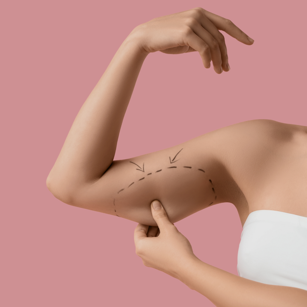 Braquioplastia