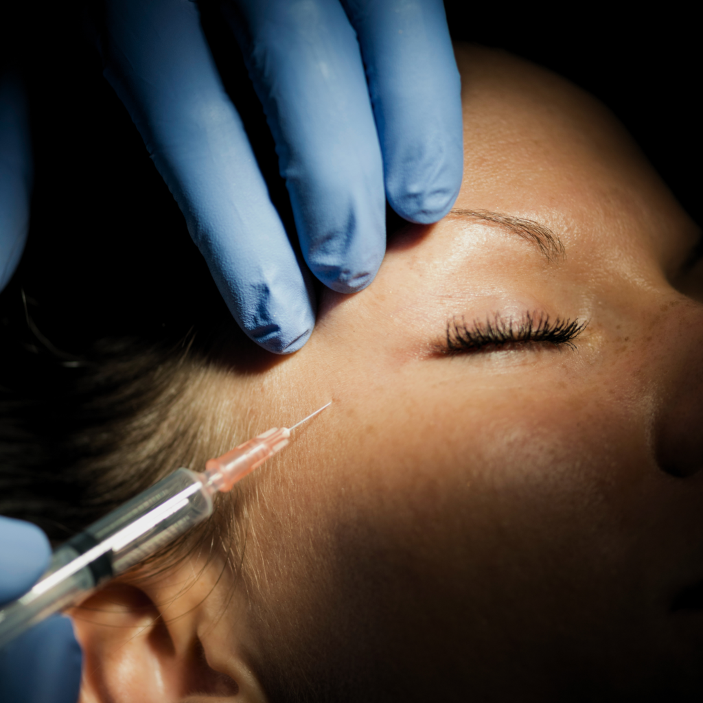 Botox (toxina botulínica)