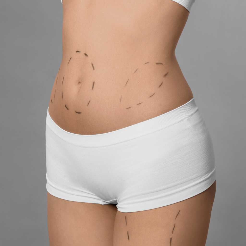 Protocolo Cirurgia Saudável