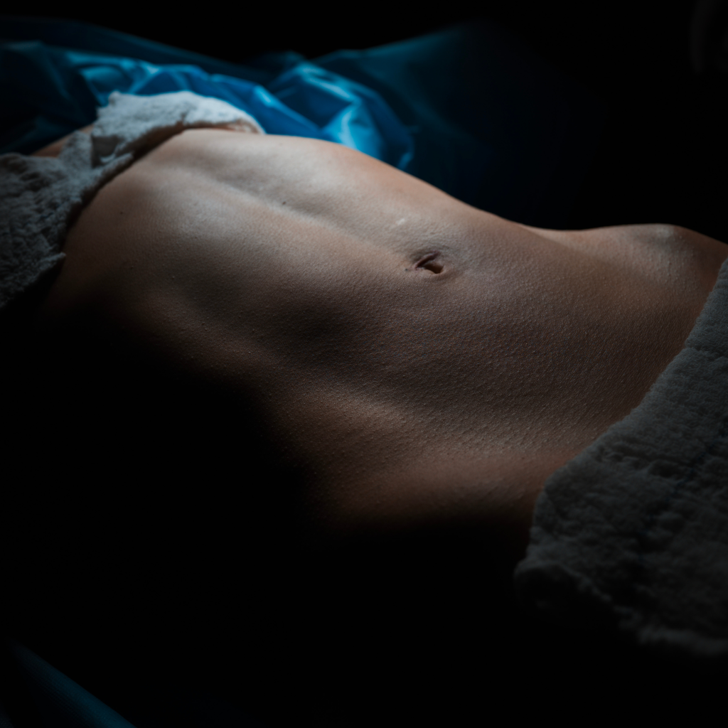 Lipoescultura